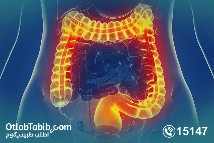 علاج-القولون-بالاعشاب