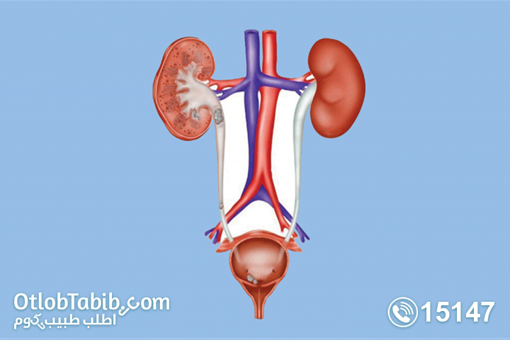 علاج التهاب المسالك البولية عند النساء