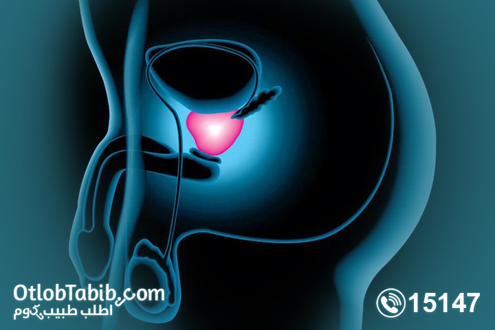 Prostate congestion, symptoms and treatment methods