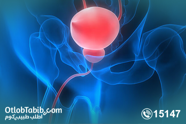 اعراض التهاب المثانة والمسالك البولية عند الرجال والنساء