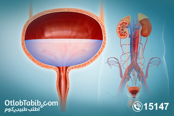 Inflammation of the bladder in men, its effect on an erection