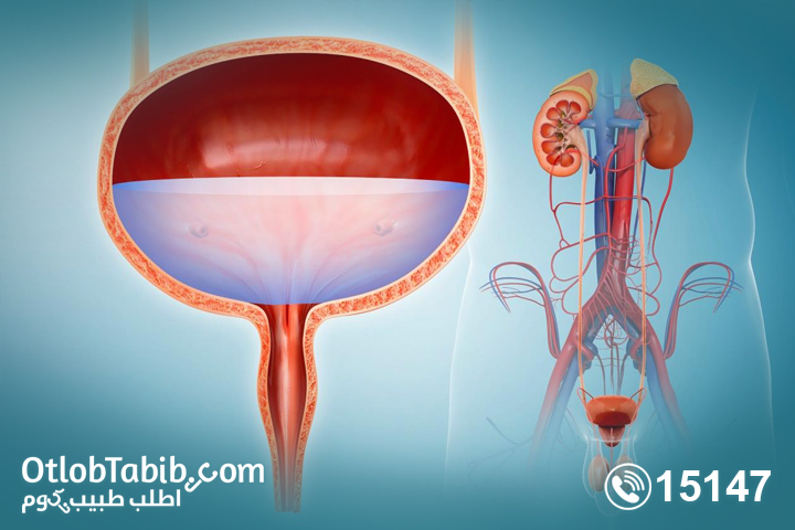 التهاب المثانة عند الرجال تأثيرها على الانتصاب