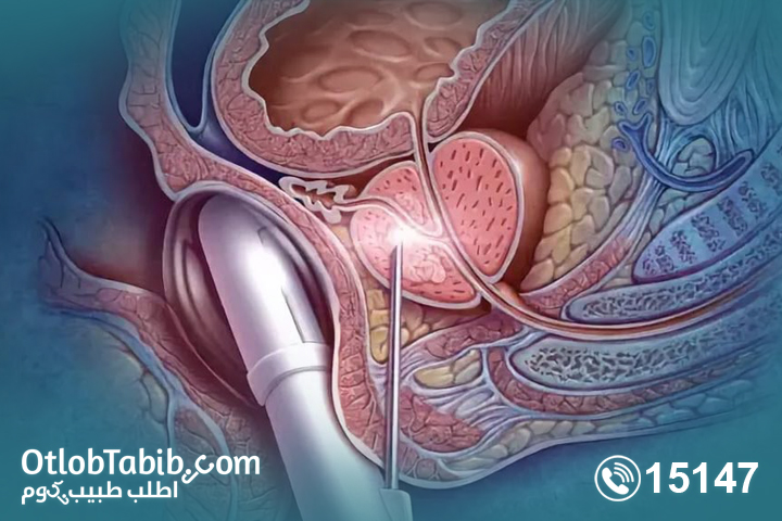 تعرف على الأمراض المتعلقة بـ احتقان البروستاتا 