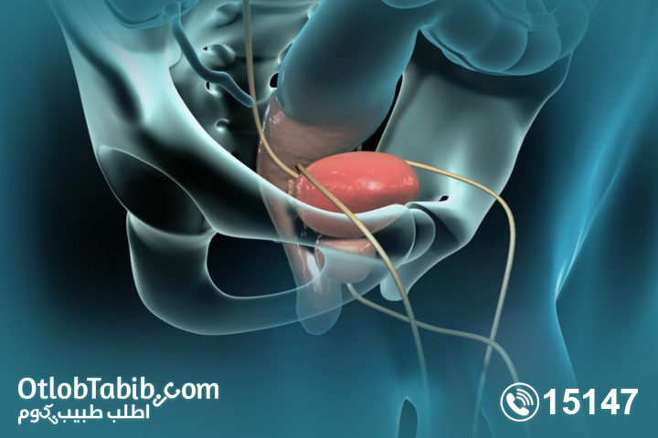 What is prostate enlargement, its causes and methods of treatment