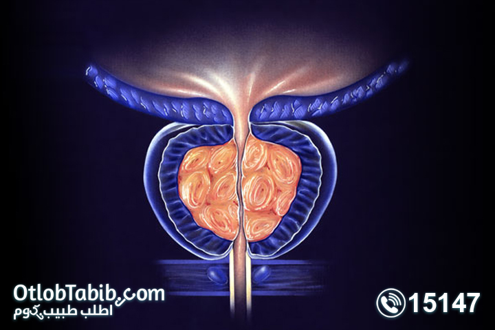 هل هناك علاج لـ تضخم البروستاتا بالأعشاب ؟ 