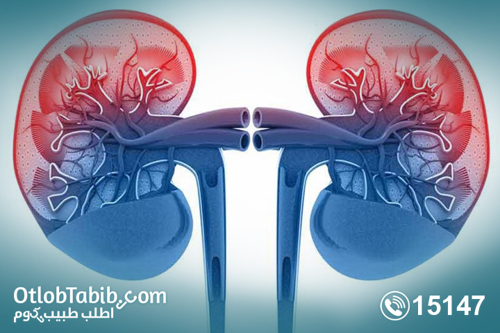 Glomerulonephritis.. Learn about prevention methods and causes