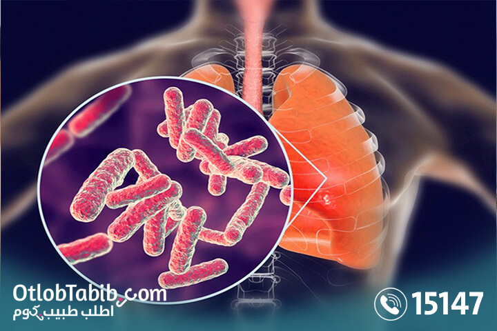 Is tuberculosis fatal? Find out the full information here