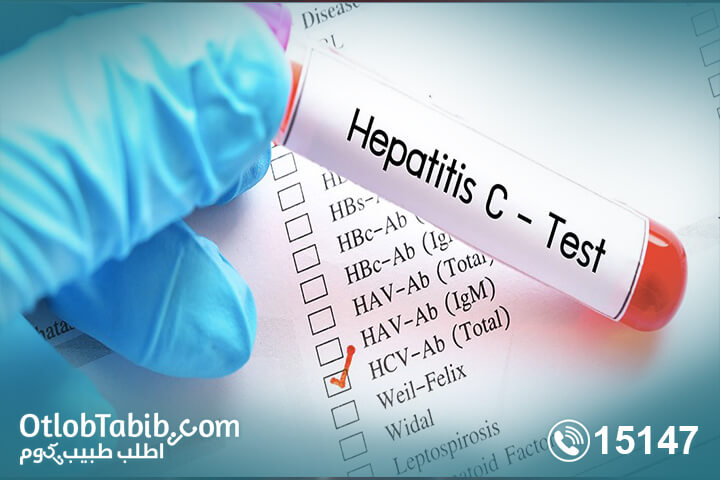 What does a virus C patient eat & how to adapt with treatment?