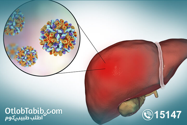 إعرف أكثر عن التهاب الكبد الوبائي ب والحمل وأعراضه ومضاعفاته