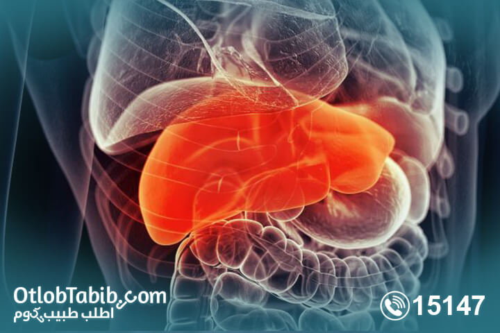What is fatty liver? Its causes and dangers .. Know More