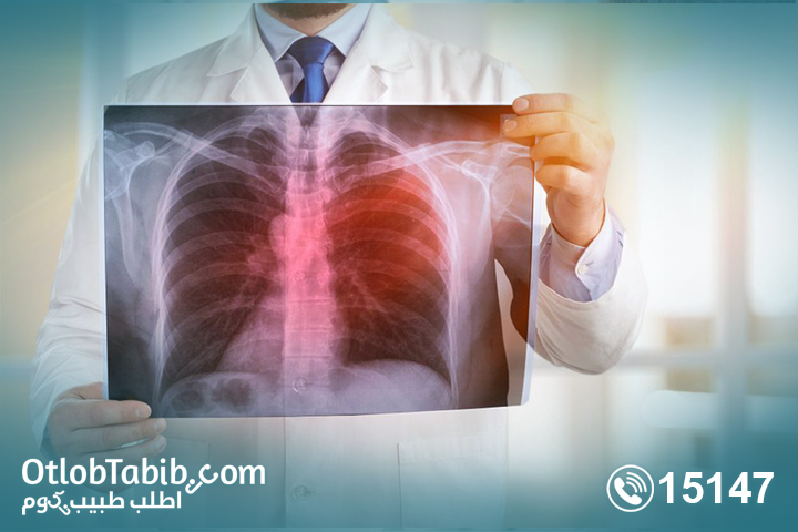 Consult a respiratory doctor in Egypt with Otlob Tabib
