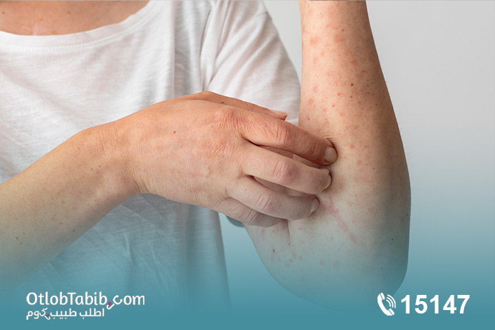 طرق الوقاية من حساسية الصيف الموسمية