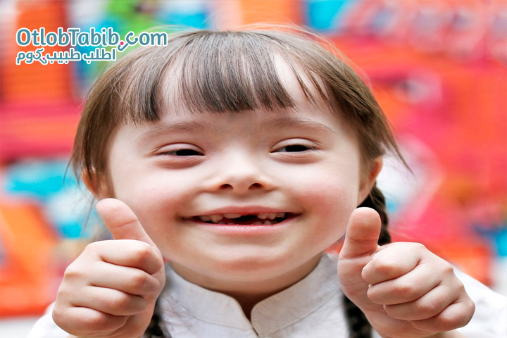 How to deal with a child with Down syndrome and modify his behavior