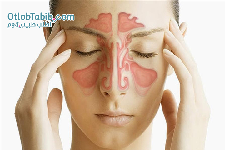 Sinusitis ... its types ... symptoms and treatment