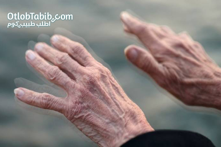 Parkinson's paralysis, what is it, its symptoms, prevention